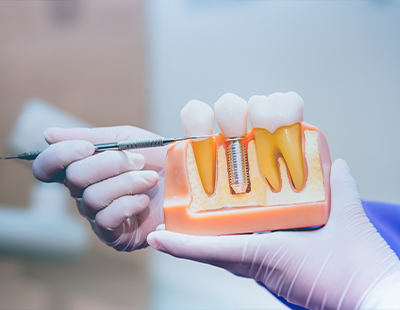 Steven E. Marek, DDS, LTD | Dentures, Teeth Whitening and Dental Bridges