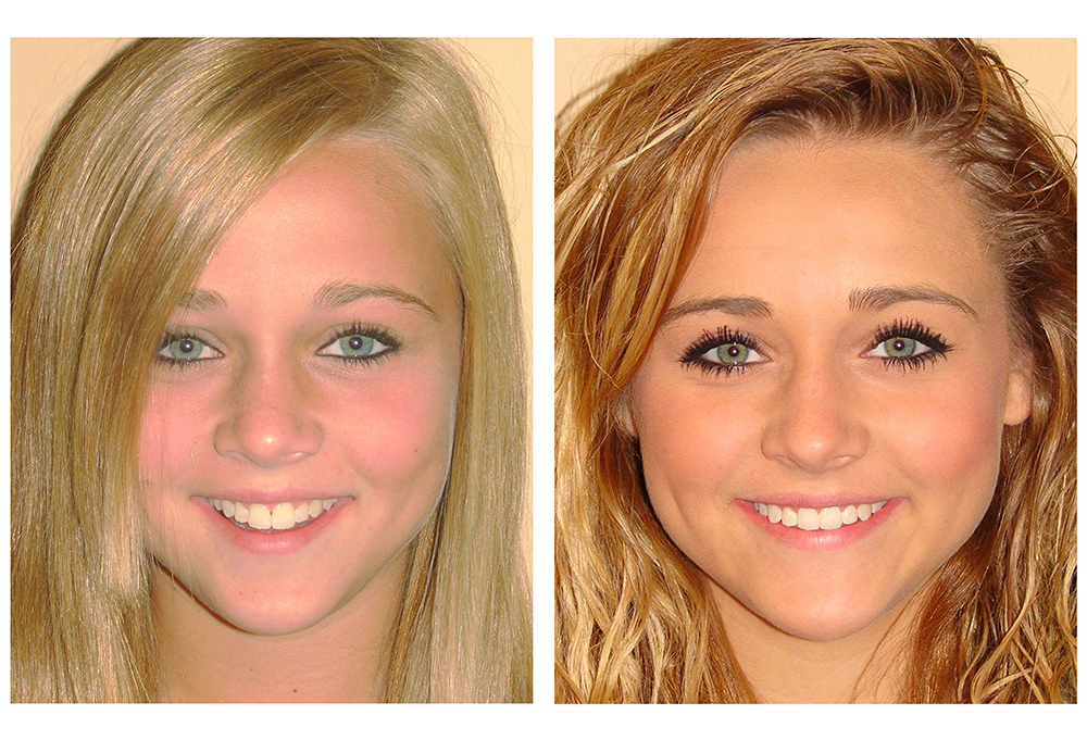 Steven E. Marek, DDS, LTD