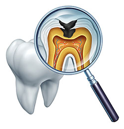 Steven E. Marek, DDS, LTD | Dental Cleanings, Teeth Whitening and Root Canals