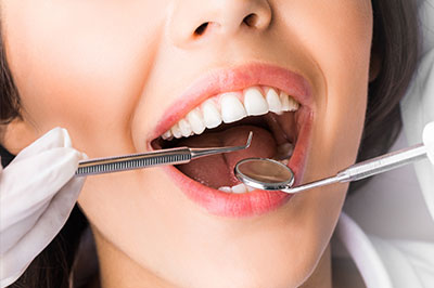 Steven E. Marek, DDS, LTD | Oral Exams, Veneers and Implant Dentistry