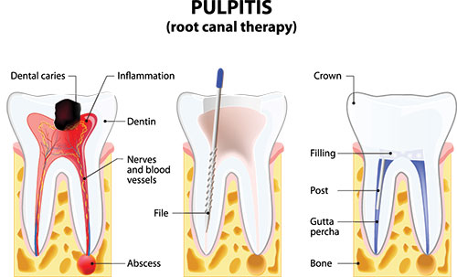 Steven E. Marek, DDS, LTD | Dental Fillings, Extractions and Preventative Program