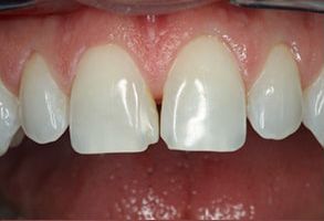Steven E. Marek, DDS, LTD | Oral Cancer Screening, Root Canals and Periodontal Treatment